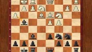 Chess Lesson: Alekhine Defence