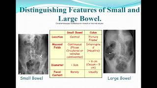 13:20-14:50 Radiological diagnosis of diseases of the digestive system