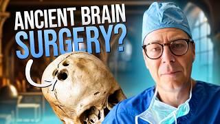 The History of Brain Surgery (SHOCKING!)