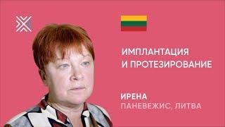 Протезирование и имплантация зубов в Минске