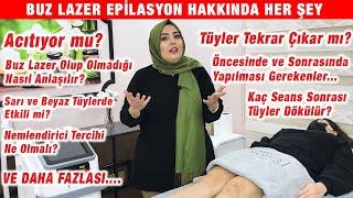 BUZ LAZER EPİLASYON  Acıtıyor mu, Tüyler Tekrar Çıkar mı, Dikkat Edilmesi Gerekenler