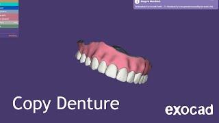 Exocad Copy Denture Tutorial