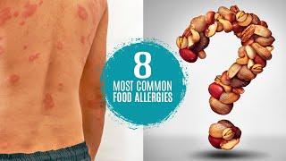 What are the 8 Most Common Food Allergies?  Symptoms, Treatment & Testing