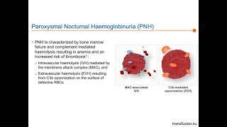 Клинические рекомендации 2021,  "Пароксизмальная ночная гемоглобинурия"