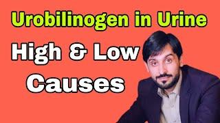 Urobilinogen in Urine | Causes | Reference Range | MLT Hub with kamran