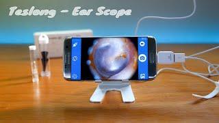 Teslong - Ear Otoscope - Unbox & Setup