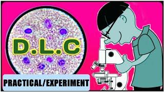 DLC Test | WBC Differential Count | Differential Leukocyte Count