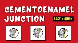 Cementoenamel Junction | Cementoenamel Junction Types | CEJ