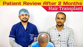 After 2 Month of Hair Transplant   ||  Patient Review With Dr. Ankit Kumar Jain, Best HairTransplant