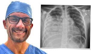 Read and Understand a Chest Xray - How I Do it!