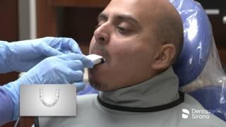 RINN Snap-A-Ray Anterior Assembly Placement | Dentsply Sirona