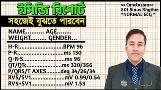 ইসিজি রিপোর্ট এত সহজ। HOW READ AN ECG REPORT। ECG INTERPRETARION । ECG REPORT IN BANGLA