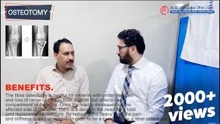 OSTEOTOMY SURGERY DONE BY DR.UMER BUTT