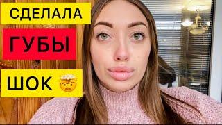 ХАРЬКОВ СДЕЛАЛА ГУБЫ ТЕПЕРЬ КАК ИСТИНАЯ УКРАИНКА ️