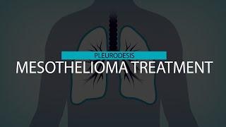 Mesothelioma Pleurodesis | Mesothelioma Hope