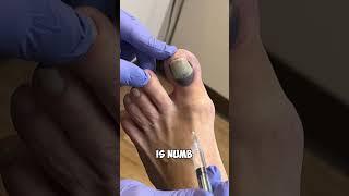 Ouch! Numbing A Toe: A Quick Fix"