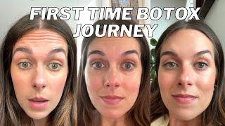 GETTING BOTOX FOR THE FIRST TIME! Why I did it, my experience and results