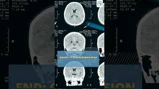 Functional Neurologic Disorder (FND) | #MCAshorts