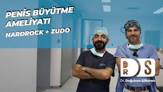 Penis Büyütme Ameliyatı Yaptık! | HardRock+ZuDo İle Kalıcı Penis Büyütme!