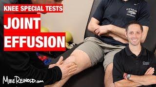 Knee Joint Line Effusion Special Test