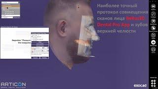 Как добиться высокого качества совмещения сканов лица и зубов в Exocad