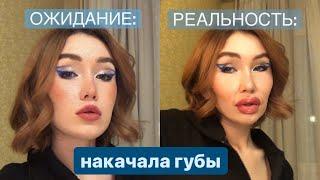 УВЕЛИЧИЛА ГУБЫ / мой опыт / часто задаваемые вопросы