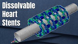 Numerical modelling of stents | Designing dissolvable stents