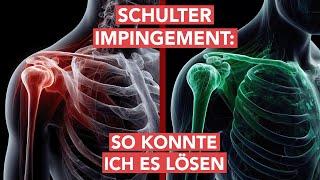 Schulter Impingement: Das hat mir geholfen - So konnte ich es loswerden