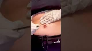 Belly Button Cleaning with Hair Bobby Pin