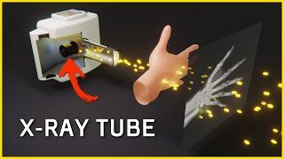 How an X-Ray Tube WorksHow X-Rays are Generated