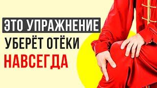 ОТЁКИ ног, причина и лечение! Отекают ноги – что делать!