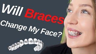 Will Braces Change My Face? | Dentist Explained (2021)