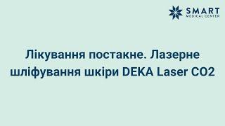 Лікування постакне | Лазерне шліфування шкіри DEKA Laser CO2