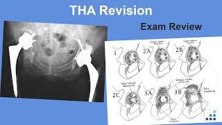 THA Revision Exam Review - Wayne Paprosky, MD