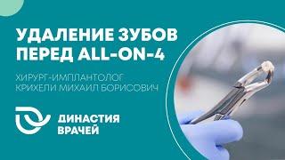 Удаление зубов во сне для ALL-ON-4 "Династия врачей" | хирург-имплантолог Крихели Михаил Борисович