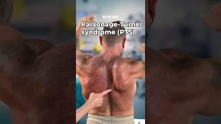 Parsonage-Turner Syndrome #parsonage #turner #syndrome #scapular #winging #nerve #injury
