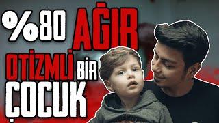 OTİZM GEÇİCİ Mİ? | OTİZM EĞİTİM