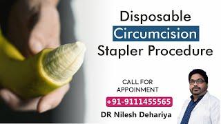 Disposable circumcision stapler Procedure