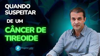 Quando suspeitar de um câncer de tireoide - Dr. Rogério Leite