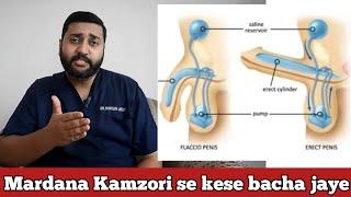 Mardana Kamzori se kese bacha jaye by Dr. Mohsin