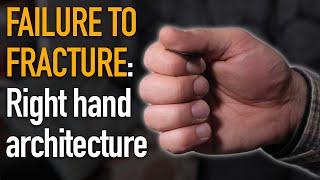 Failure to Fracture: Right Hand Architecture