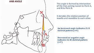 Cephalometrics Part II