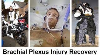 Brachial Plexus Injury Recovery