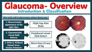 Glaucoma- Introduction & Classification (Video-1) #glaucoma #optometry