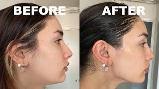TRYING A GUA SHA ROUTINE FOR A MONTH - BEFORE AND AFTER PICS