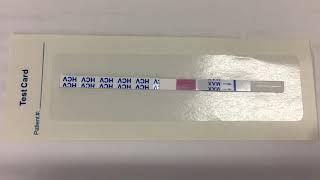 Rapid Test Manufacturer - Hangzhou AllTest Biotech Co.,Ltd.- HCV Rapid Test