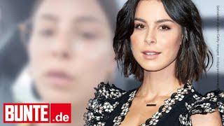 Lena Meyer-Landrut - "Erstes graues Haar einen Tag vor meinem 29. Geburtstag"