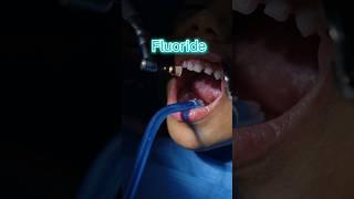 FLUORIDE - MEDICAL DEFINITION | Medical Consecutive Interpreting