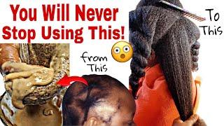 NoJoke! it's works  Your hair may become too Thick and Fuller to handle|Cloves Flaxseed n fenugreek