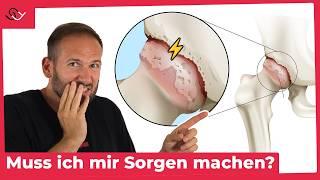 Ist dein Hüftgelenk gesund? Mach den Test! (Dauert 5 Sek.)